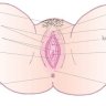 EnzoTarp